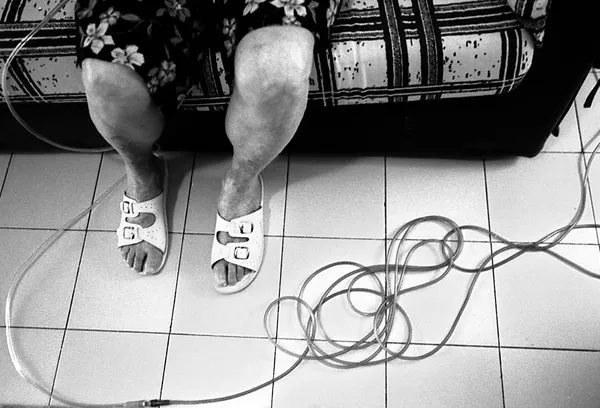 close up on old woman's feet with wires